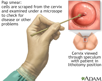 The Pap smear